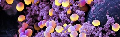 Staphylococcus Aureus y la manipulación de alimentos
